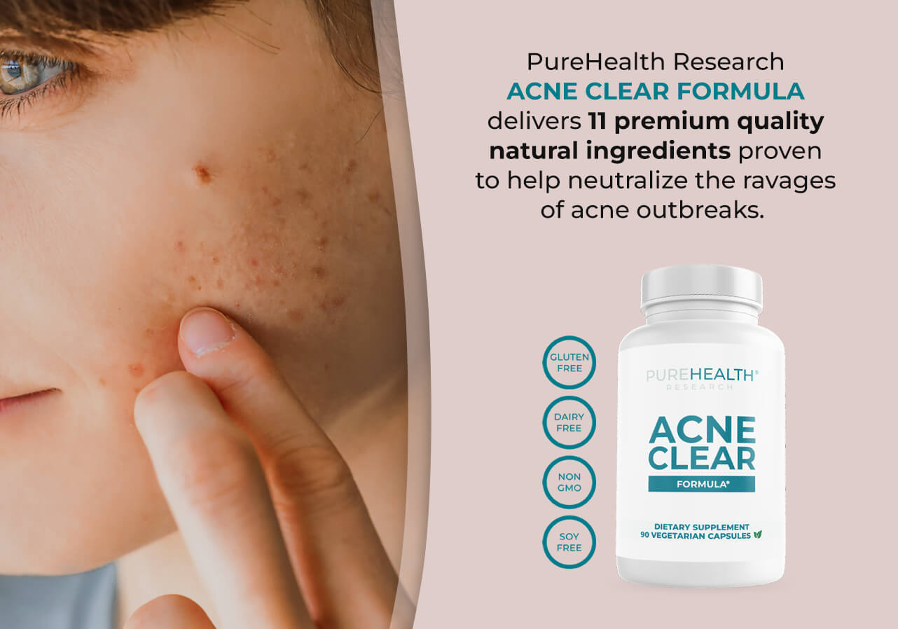 Acne Clear Formula